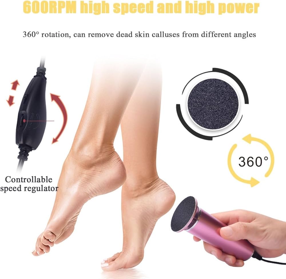 Electric calus remover