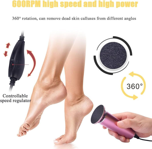 Electric calus remover